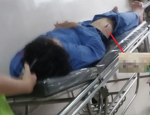 Ông Nguyễn Văn Giản, cán bộ Cục Thuế Ninh Bình bị một đối tượng bịt mặt, đi xe mô tô không biển số tiến đến gần, rút dao đâm vào đùi. Ảnh Long Vân