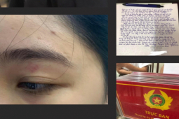 Tin tức trong ngày - Quán bánh mì nổi tiếng Nguyên Sinh bị "tố" nói khách "ngu dốt", đánh khách