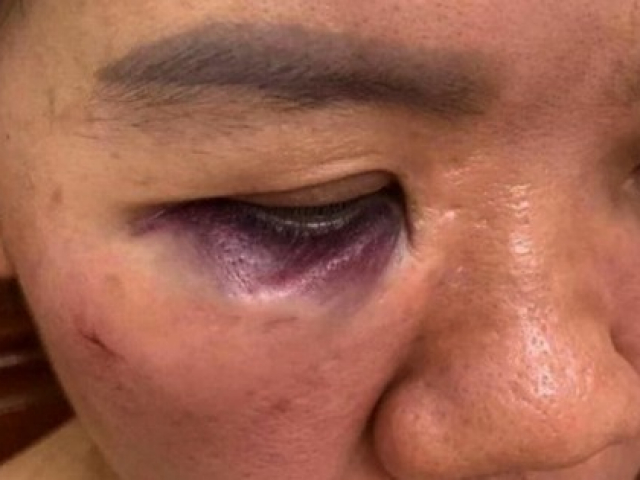 Pháp luật - Vụ nữ nhân viên điện lực bị tấn công: Tạm đình chỉ công tác 2 người