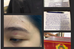 Tin tức trong ngày - Vụ nhân viên quán bánh mì Nguyên Sinh bị tố hành hung khách: Sẽ giám định thương tích của khách