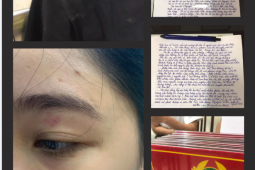 Tin tức trong ngày - Vụ nhân viên quán bánh mì Nguyên Sinh bị tố hành hung khách: Sẽ giám định thương tích của khách 