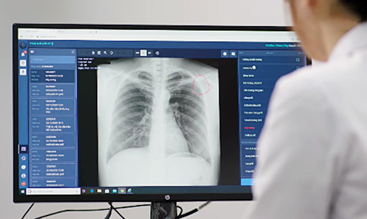 DrAid&nbsp;X-quang Ngực là&nbsp;trợ lý AI tiên tiến cho bác sĩ chẩn đoán hình ảnh.