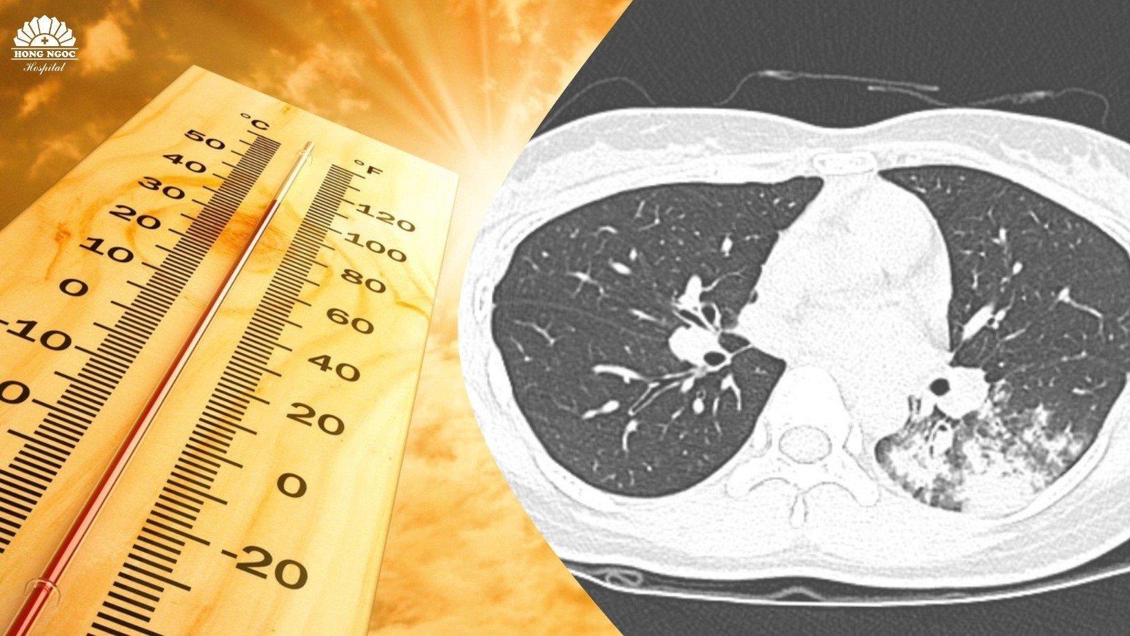 Nắng nóng kéo dài, số người nhập viện vì viêm phổi tăng cao ở cả người lớn và trẻ em