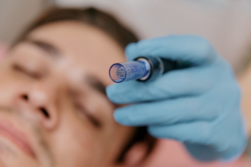 Vì sao đàn ông cũng nên lăn kim? - 4