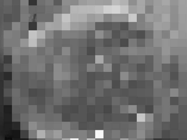 Sức khỏe đời sống - Người đàn ông bị cắt một phần "cậu nhỏ" vì lý do thường gặp