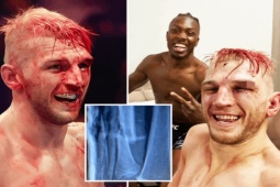 Thể thao - UFC cực nóng: Võ sỹ đánh bại "Thần chết", gãy xương tay vẫn đánh đến cùng