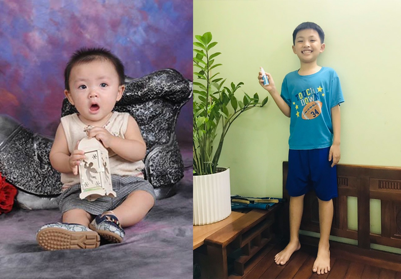 Bé Siro lúc 1 tuổi hay ốm, chiều cao tăng chậm. Hiện tại Siro mới 9 tuổi đã cao 140cm, cao hơn cả bạn 10 tuổi. Bé dùng Dimao Pro hàng ngày.