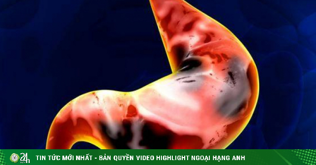 Gia đình có 3 người liên tiếp bị ung thư dạ dày, không ngờ món ăn này chính là nguyên nhân