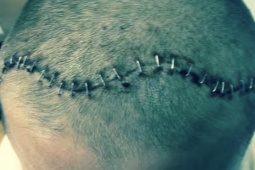 Sức khỏe đời sống - Bỗng dưng trở nên mệt mỏi, dễ cáu giận, hai bố con cùng phát hiện ung thư não