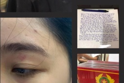 Tin tức trong ngày - Vụ 2 nhân viên quán bánh mì Nguyên Sinh đánh khách: Phạt 13 triệu đồng