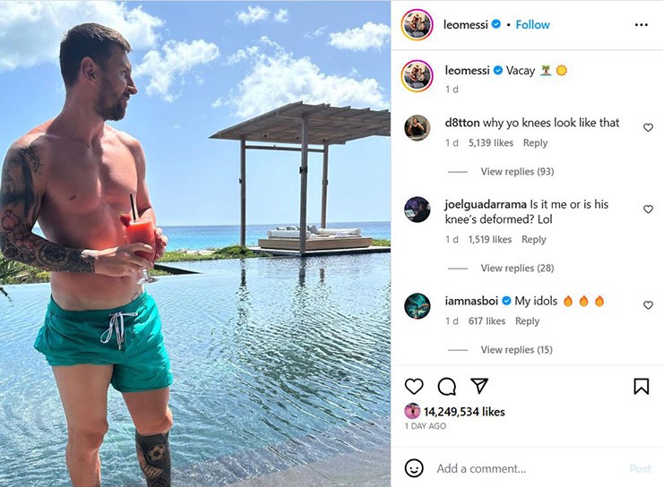 Hình ảnh đầu gối "bất thường" của Messi