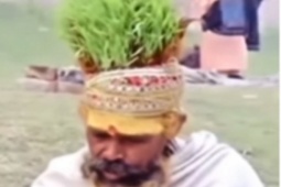 Phi thường - kỳ quặc - Hy hữu: Người đàn ông trồng cỏ trên đầu, lấy tóc làm phân bón