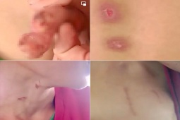 Pháp luật - An Giang: Điều tra vụ cha dượng hành hạ dã man con riêng của vợ