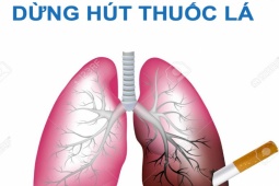 Sức khỏe đời sống - Những ai nên đi khám để tầm soát ung thư phổi?