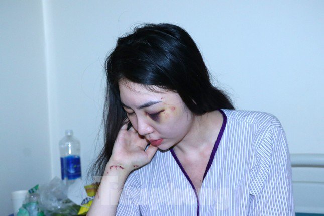 Chị T. hiện đang điều trị tại bệnh viện trong tình trạng bị đa chấn thương