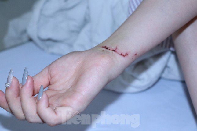 Chị T. bị thương tích nhiều chỗ trên cơ thể