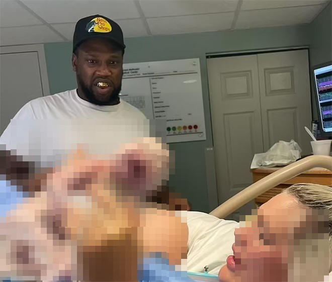  Brett Stills đã rất bàng hoàng khi chứng kiến cảnh con được sinh ra từ bụng mẹ. Ảnh: Daily Mail