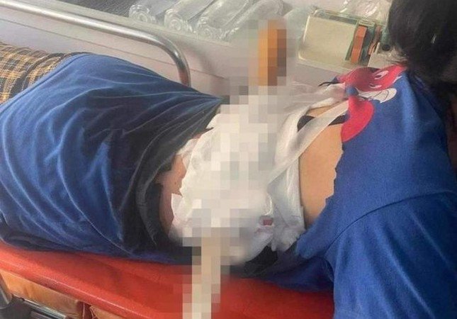 Nạn nhân bị dao xuyên lưng.