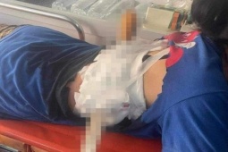 Pháp luật - Chồng phóng dao xuyên lưng vợ