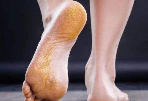 Thấy 5 dấu hiệu này ở bàn chân bạn nên chụp CT gan sớm - 5