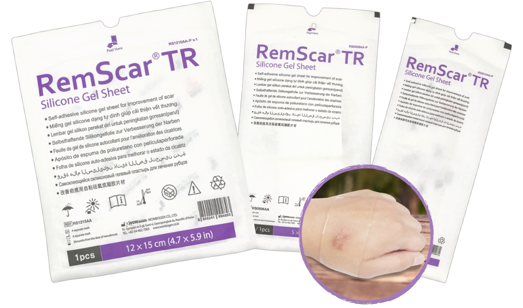 Gel Silicone: Bí quyết đơn giản để quản lý với sẹo bỏng - 3