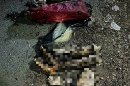 Tin tức trong ngày - Tin tức 24h qua: Công an Bình Dương thông tin về vụ đôi chân người bị đốt cháy