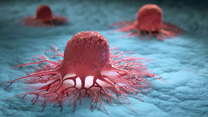 Tế bào ung thư - Ảnh minh họa từ Internet