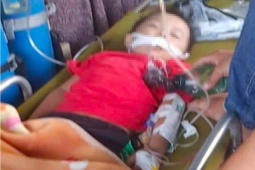 Tin tức trong ngày - Ngủ dưới nền nhà, bé 3 tuổi bị rắn cực độc cắn nguy kịch