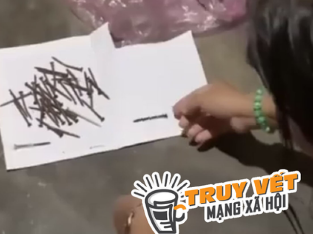 Tin tức trong ngày - Thông tin một phụ nữ lấy 40 cây đinh từ vết thương trên cánh tay: Địa phương nắm tình hình