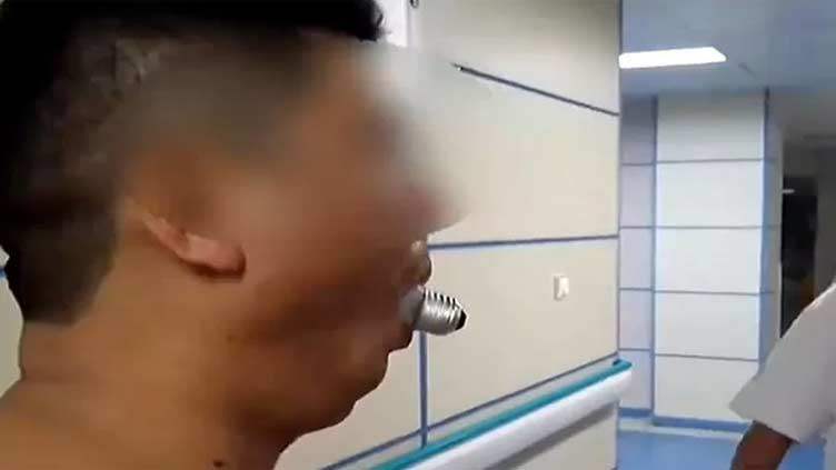 Người đàn ông cầu nghịch dại bị mắc kẹt bóng đèn trong miệng.