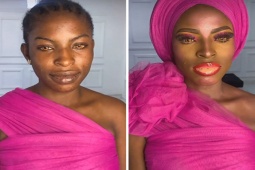 Cười 24H - Trở về từ thẩm mĩ viện, bỗng thấy cuộc đời tối đen như “tiền đồ chị Dậu” (P2)