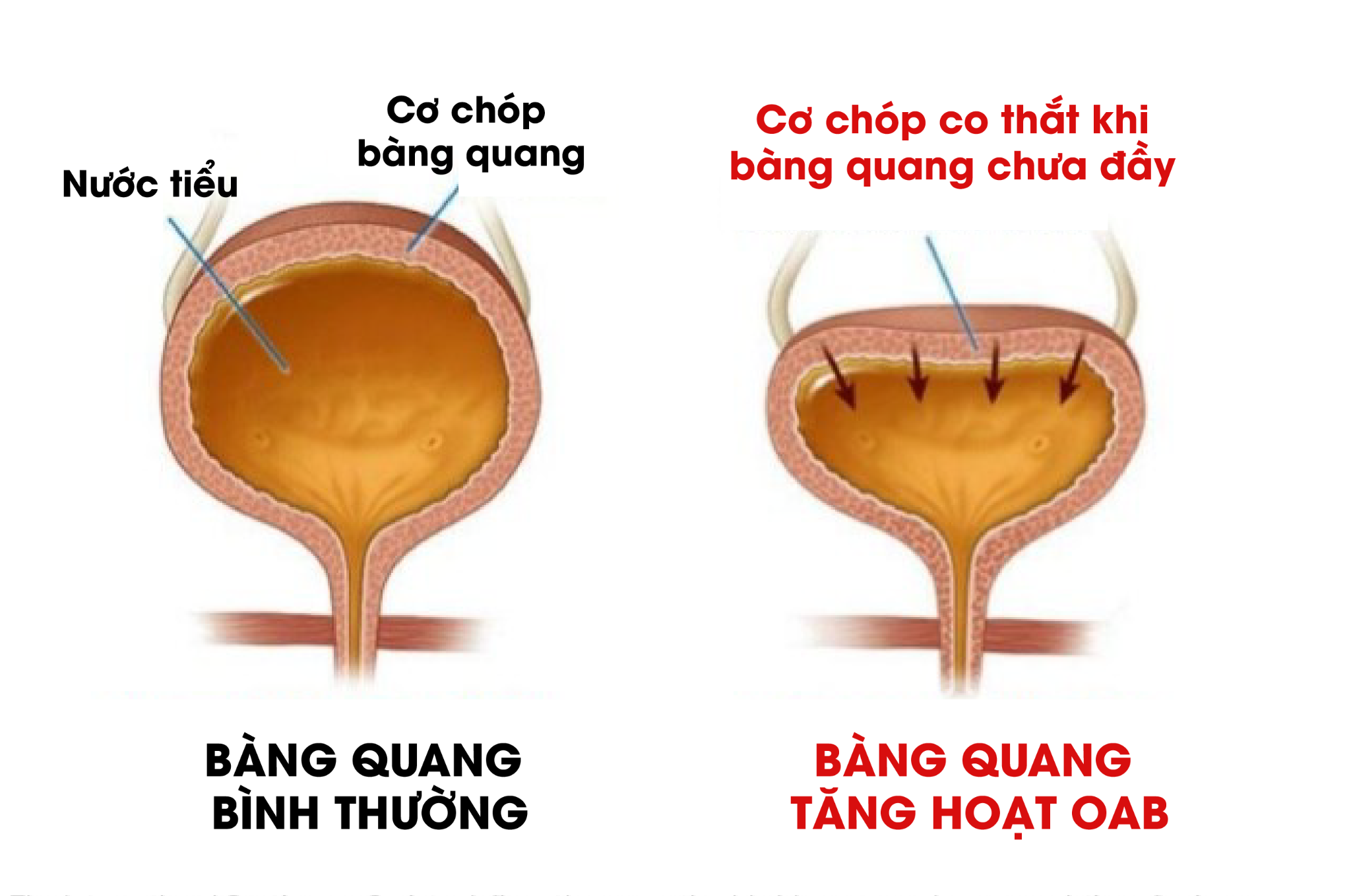 Tiểu nhiều khi trời mưa hay nghe tiếng nước chảy: coi chừng bàng quang mắc bệnh! - 2