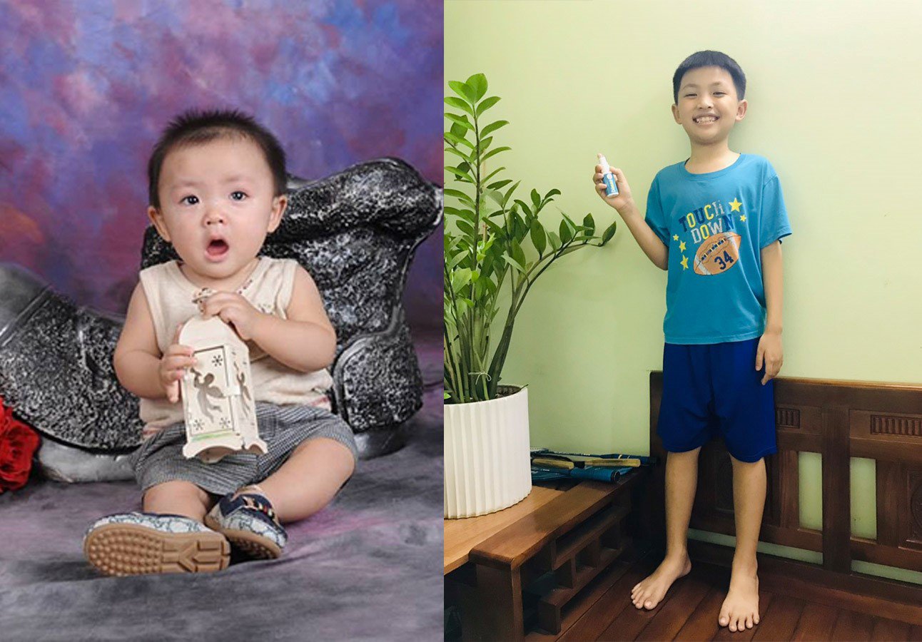 Bé Siro lúc bé hay ốm, chiều cao tăng chậm nhưng sau một thời gian sử dụng Dimao Pro kết hợp chế độ dinh dưỡng tốt, bé phát triển cao rõ rệt. Siro mới 9 tuổi đã cao 140cm, cao hơn cả bạn 10 tuổi.