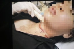 Pháp luật - Cảnh sát thông tin vụ cô gái trẻ báo án bị cắt cổ, cướp tài sản ở Bình Dương