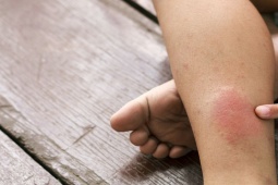 Sức khỏe đời sống - 5 dấu hiệu của "kẻ giết người thầm lặng" có thể tấn công khi bạn đi du lịch