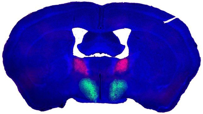 Các tế bào thần kinh của não chuột đực gồm vùng dưới đồi trước khi sinh (POA) (màu xanh lá cây) và nhân giường của stria terminalis (BNST) (màu hồng) được kết nối với nhau và điều chỉnh hành vi tình dục. (Ảnh: Tiến sĩ Daniel Bayless, phòng thí nghiệm Shah)