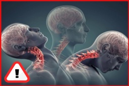 Sức khỏe đời sống - Đau lưng, mỏi vay gáy, tê bì chân tay "đeo bám" - đâu là những sai lầm bạn hay mắc phải?