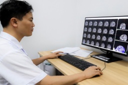 Sức khỏe đời sống - Đau đầu, chóng mặt thường xuyên, nam sinh 20 tuổi đi khám phát hiện u máu trong não