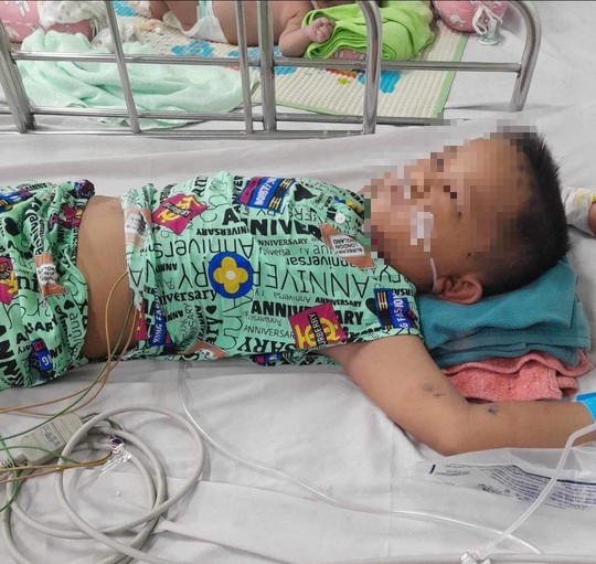 3 con của chị Lượng bị đốt hàng chục mũi. Ảnh: Ly Trương