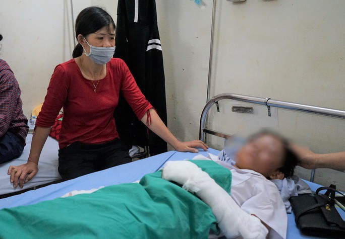 Một học sinh bị bóng ở tay và mặt đang được điều trị tại Bệnh viện Đa khoa huyện Yên Định
