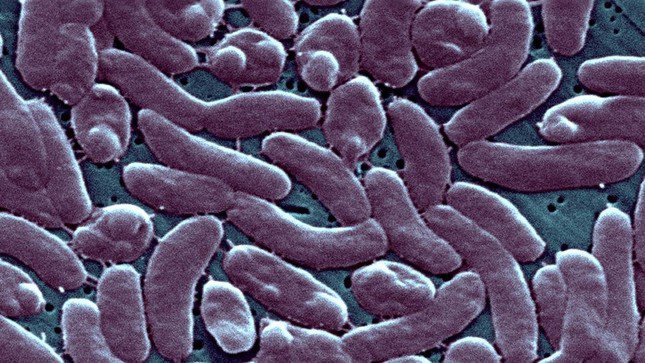 Vibrio Vulnificus là một loại vi khuẩn hình que có thể gây nhiễm trùng đe dọa tính mạng (Ảnh: BSIP/Cộng tác viên qua Getty Images)