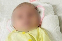 Sức khỏe đời sống - Bé sơ sinh uốn ván nguy kịch vì gia đình dùng kéo tự cắt rốn tại nhà