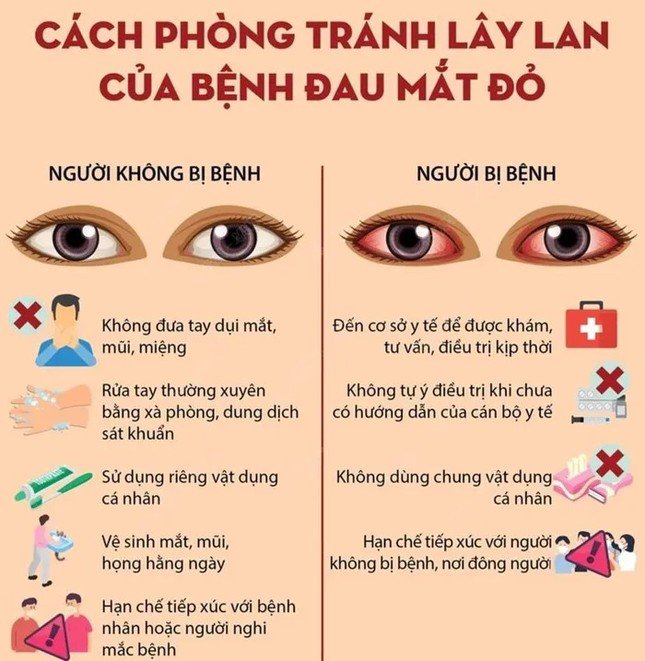 Cách phòng tránh lây lan của bệnh đau mắt đỏ. Ảnh: TTXVN