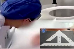 Giáo dục - du học - Giáo viên gây thương tích nặng cho học sinh bằng eke, lời thanh minh gây phẫn nộ