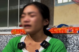 Pháp luật - Diễn biến mới vụ thiếu nữ 16 tuổi bị chủ đánh đập, bắt ăn thằn lằn sống khi làm thuê