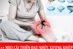 Sức khỏe đời sống - Đau lưng, mỏi gối, tê bì chân tay “hoành hành” ngày mưa gió - Cẩn thận hối không kịp!