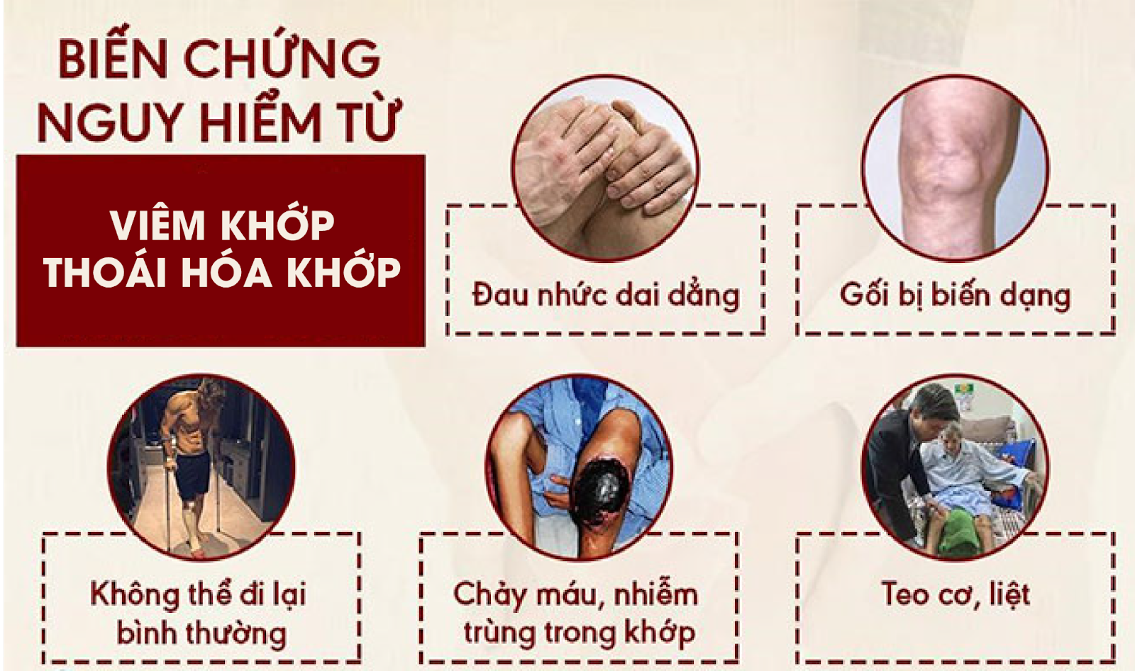 Đau lưng, mỏi gối, tê bì chân tay “hoành hành” ngày mưa gió - Cẩn thận hối không kịp! - 2