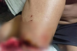 Pháp luật - Đi cướp còn bắt bị hại nấu mì ăn lót dạ, 2 nghi phạm bị bắt