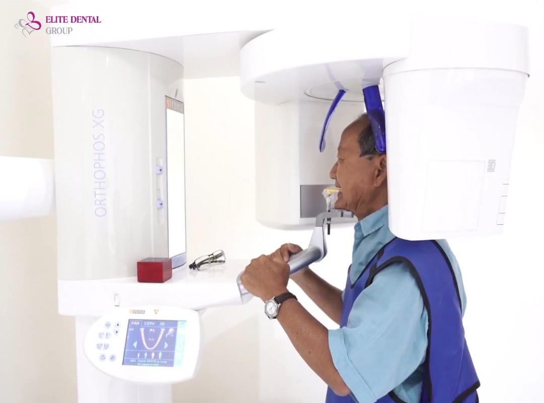 Chụp CBCT cho hình ảnh 3D sắc nét quy trình nhanh chóng, đảm bảo an toàn, phù hợp cả người lớn tuổi trồng răng Implant.