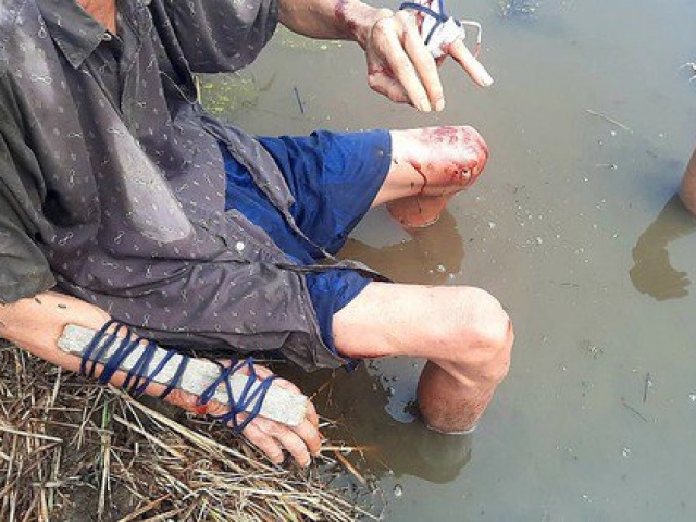 Pháp luật - Tranh chấp đất ở Long An, 4 cha con bị chém dã man